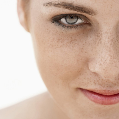 Whitening Therapy Freckles - Spots