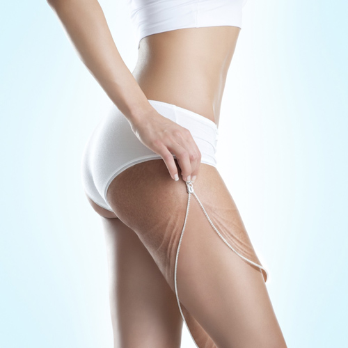 Cellulite Treatment - Slimming