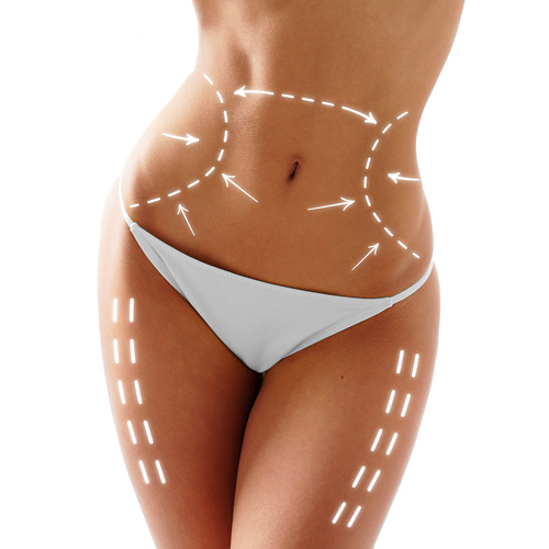 Cryolipolysis CRYOTECH-PLUS